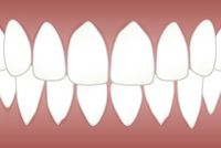 Изберете нашите  зъбни импланти 1