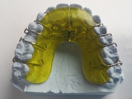 Ефектни зъбни импланти цени 23