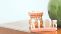 зъбен мост - 53407 - вижте повече
