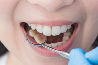 зъболекар русе - 22539 - вижте нашите предложения